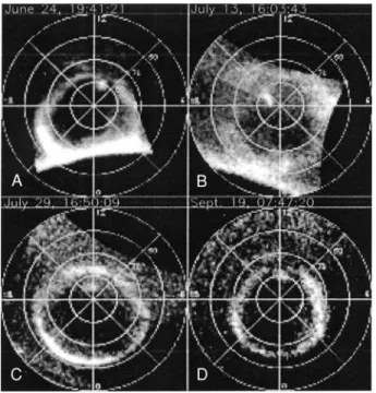 Figure 1. Examples of observations of the proton imager of the FUV on four different days in 2000