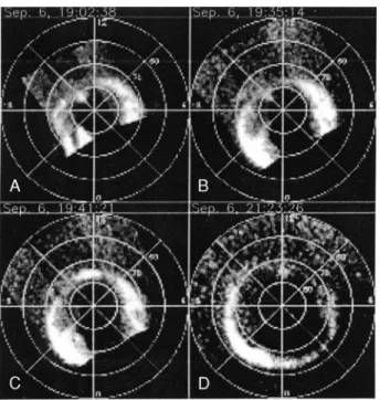 Figure 8. Examples of observations of the FUV proton imager on 6 September 2000. The format is the same as in Figure 1.