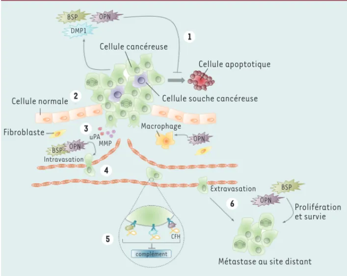 Figure 2.  Rôles des protéines SIBLING dans les différentes étapes de la progression cancéreuse et  métastatique