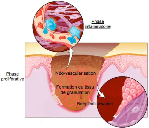 Figure  1.3  :  Schématisation  des  principales  étapes  de  la  guérison  des  plaies  de  la  peau