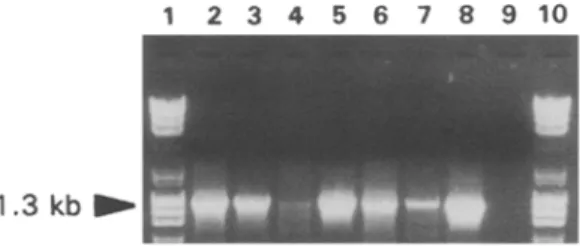 Fig. 2.  Electrophoretic gel of the RT-PCR  assays performed with primers  POT1  and POT2  on  RNA  extracted  from  a  healthy  N