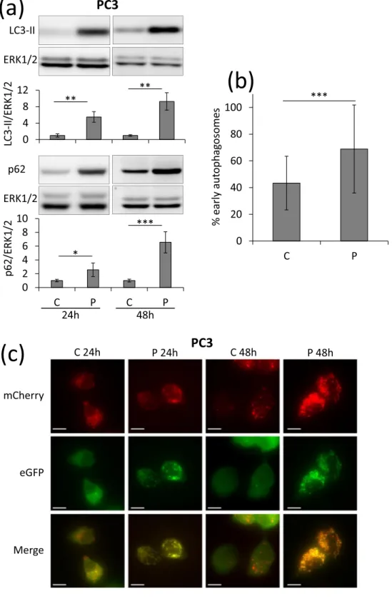 Figure 1.  Propranolol blocks autophagy in PC3 cells and induces a massive accumulation of autophagosomes