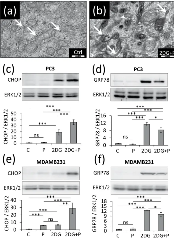 Figure 6. 2DG  +  P induces ER stress in PC3 and MDAMB231 cells. PC3 cells and MDAMB231 were left  untreated (C) or treated with 2DG (10 mM), propranolol (P) (100 µM) or both together (P + 2DG) for the  indicated times
