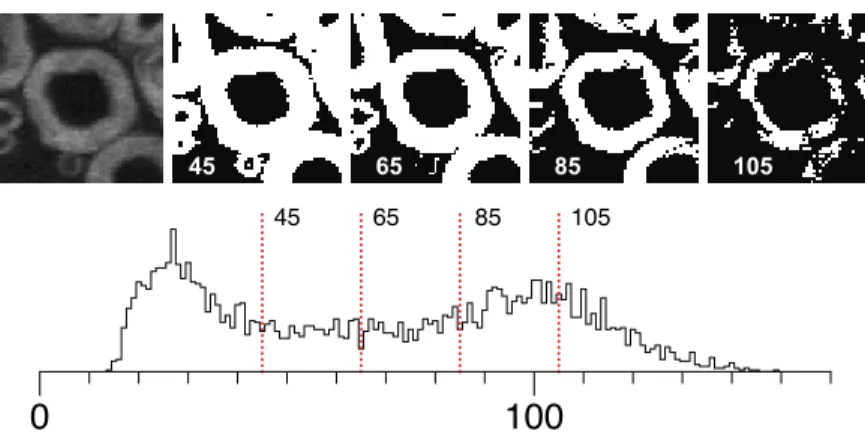 Figure 1.9 – Application of different threshold level to a CARS microscopy image from a transverse section of mouse spinal cord showing the myelin surrounding the axons