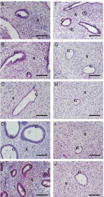 Figure 2 Haematoxylin-eosin staining at 1, 2, 3 and 4 weeks after endometrial graft in SCID mouse treated with  E 2  (A-D); endometrial graft in SCID mouse treated with E 2  + LNG (F-l); (E) proliferative eutopic endometrium; 