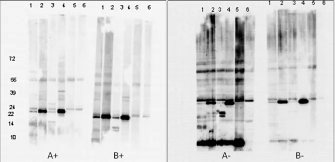 Figure 1: IgE-immunoblot of hazelnut extracts, prepared with (A+, B+) or without (A-, B-)  protease inhibitors, with serum from four hazelnut-allergic patients (lane 1-4), one control 