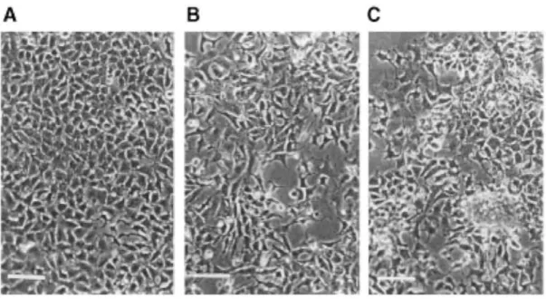 Figure 2: Morphology of the MCF-7.C (A), MCF-7.fgf-3 (B) and MCF-7-fgf-4 (C) cells in monolayers on  plastic