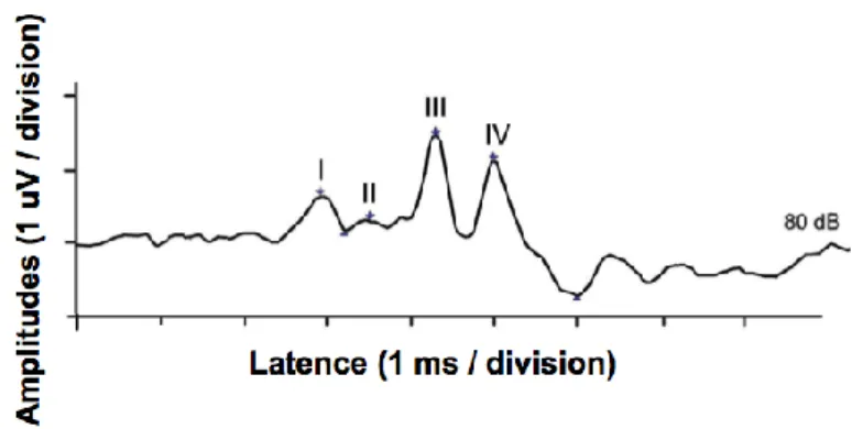 Figure 8 :  tracé de PEATC, à l’intensité de 80 dB, identifiant les 4 noyaux relais (nuclei)  le long des voies auditives.