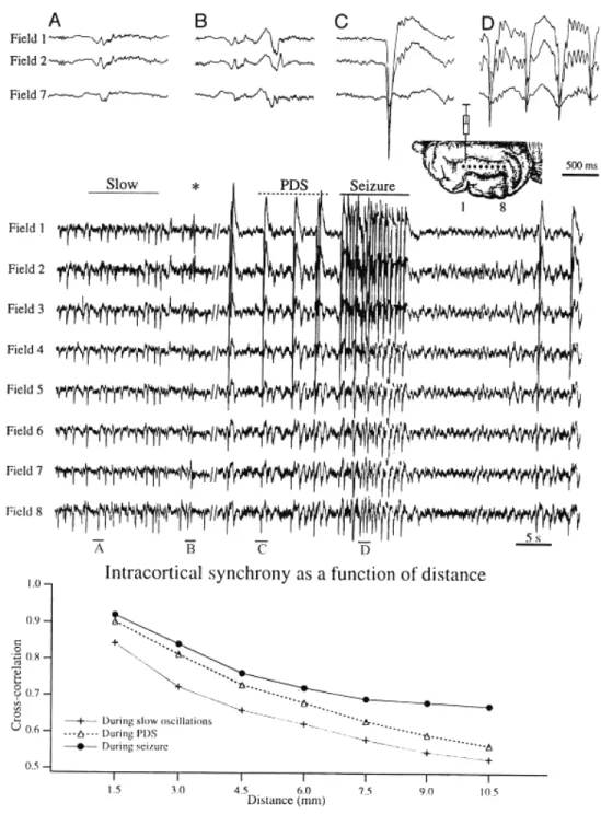 Figure 4-2. Evolution from slow oscillation to isolated PDSs and SW seizure. Cat under ketamine–