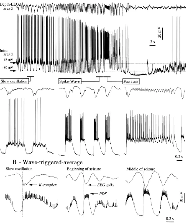 Figure 4-4. Spontaneously occurring seizure, developing without discontinuity from slow (sleep-like)  oscillation