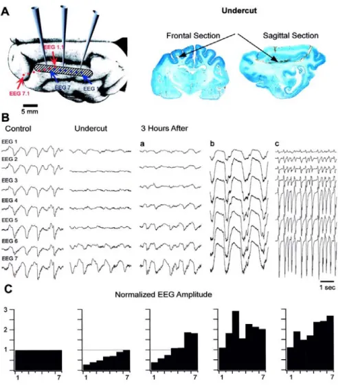 Figure 7-1. Slow oscillation in intact suprasylvian gyrus is modified by cortical undercut
