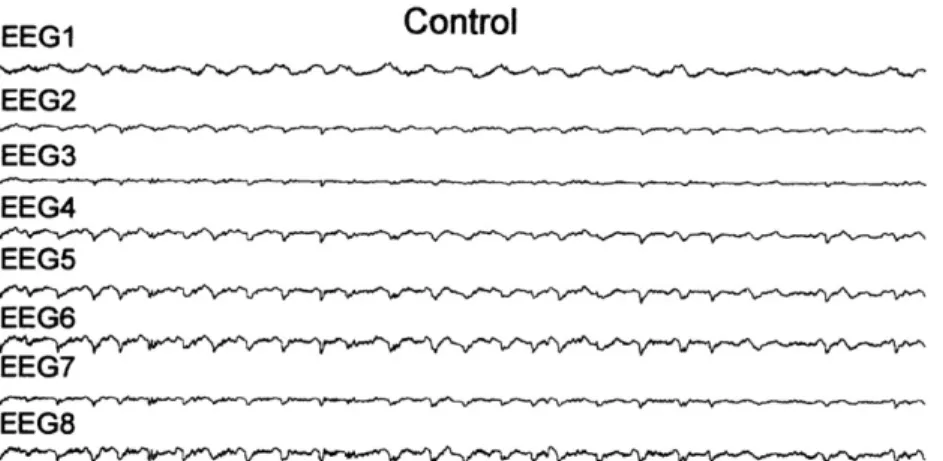 Figure 7-2. Spontaneous electrographic seizures in the suprasylvian gyrus were generated at the border  between intact and undercut cortex