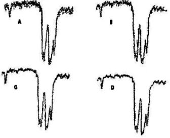 Figure 2.7 Relation entre le nombre de points et le degré de lissage : A) Données brutes, B)  Lissage à 5 points, C) Lissage à 9 points, D) Lissage à 17 points