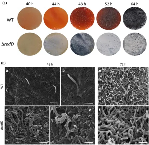 Figure 1. Effect of the redD inactivation on morphological differentiation of  S. coelicolor