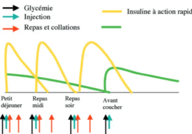 Figure 1 : Deux injections d’un mélange d’insuline sont réalisées par jour le matin et le soir avant le souper