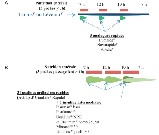 Fig. 1. Nutrition entérale en 3 poches par jour. A. Passage de la nutrition entérale rapide en gravité (&lt; 2 heures)