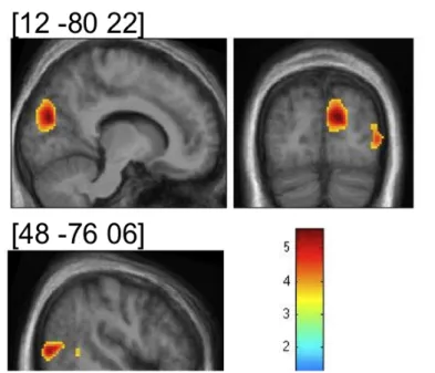 Figure   1:   fMRI   results   of   the  group  (Blind  >  Sighted)   by  condition  (Spatial  >  Pitch)   interaction  analysis (display: p uncorrected < 0.001)