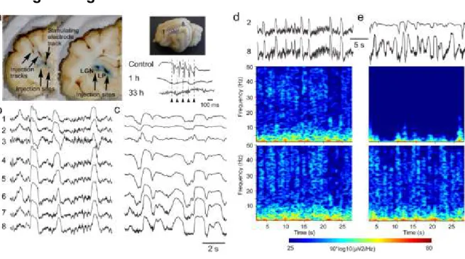 Figure 2.1 Effects of partial thalamic inactivation on the cortical slow oscillation 