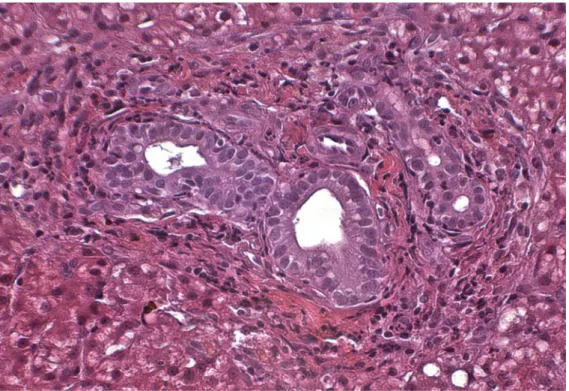 Figure 4: Liver biopsy  