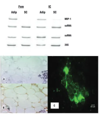 Figure 2. A. Representative examples of electrophoretic patterns of  RT-PCR products of NRP-1 mRNA using total RNA isolated from adipocytes (adip) and sedimented cells (SC) from femoral (Fem) and  iliac  crest  (IC)  bone  marrow