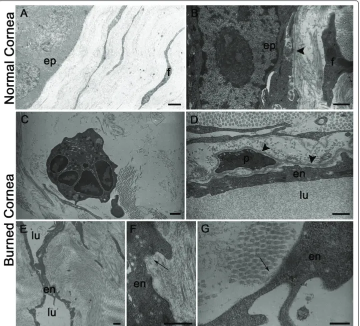 Figure 2 Electron microscopy of normal or burned mouse cornea. (A, B): Normal cornea reveals epithelial cells (ep) apposed on a regular basement membrane (arrowhead in B)