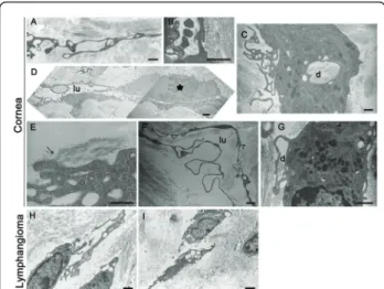 Figure 3 Electron microscopy pictures of lymphangiogenesis in vivo . Lymphangiogenesis was observed after thermal cauterization of the cornea (A-G) and in lymphangioma (H, I)