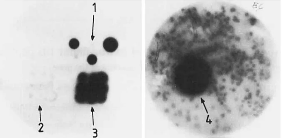 Fig. 1. Streptomyces  R61  DD-peptidase-producing colonies  us  detected  with  the  immunological  test