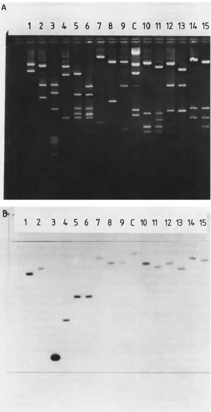 Fig. 3. Agarose gel electrophoresis  of  p D M L l l l  digests  ( A )   and hybridization with  the nucleotide probe  ( B ) 