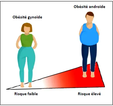 Figure 1. Patrons de distribution des graisses chez l’humain et risque cardiométabolique  associé