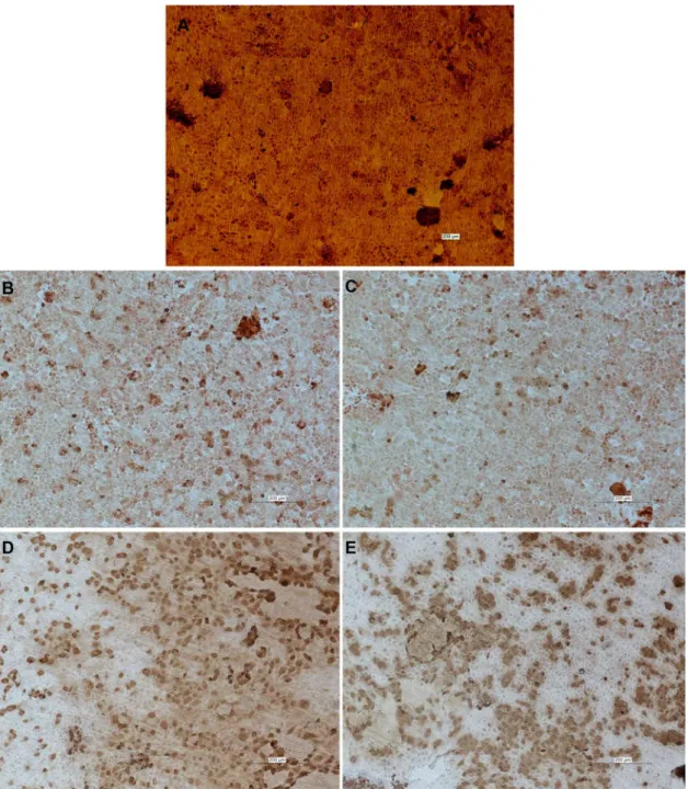 Fig. 3. Immunostaining for AQP1, ClC-5, megalin, SGLT1, and SGLT2 in primary PTC. Immunostaining of 7-day-old primary PTC with primary antibodies raised against AQP1 (A), ClC-5 (B), megalin (C), SGLT1 (D) or SGLT2 (E)