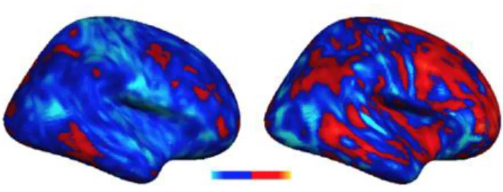 Figure 8 - Cerveaux de deux autistes pour la même tâche