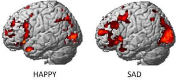 Figure 2: Zones cérébrales activées visibles par IRMf traduisant des émotions : la joie (à gauche) et la  tristesse (à droite), Kassam, Markey, Cherkassky, Loewenstein &amp; Just, 2013 