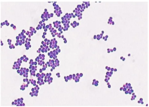 Figure 1 S. aureus, coloration de Gram. ASM Microbelibrary Smith© 