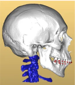 Figure 7 : Image 3D diagnostique 