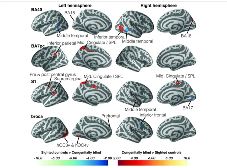 FIGURE 3 | Differences in resting state functional connectivity between blind and sighted controls (somatosensory and language ROIs)