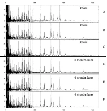 Figure 2 shows 3 spectra for a quality control serum sample on CM10 array, before starting the  ana-lysis and 6 months later