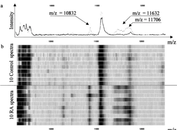 Figure 3. Potential biomarkers (m/z ⫽ 10,832, 11,632, and 11,706) on CM10 array, distinguishing patients with rheumatoid arthritis (RA) from controls