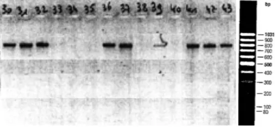 Figure 2 – Extrait de migration par électrophorèse sur gel d'agarose des produits de  PCR (amorces des CTX-M du groupe 1)  de 14 souches d'EBLSE 