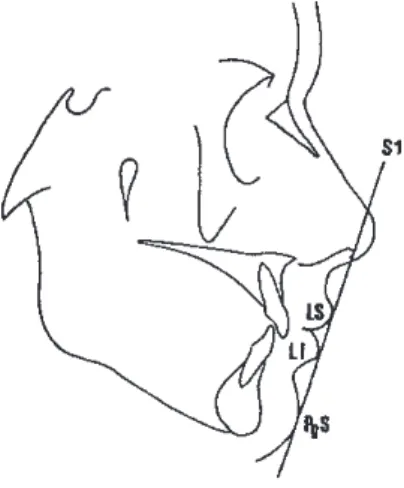 Figure 1 (11) : ligne S avec  LS = lèvre supérieure ; LI = lèvre inférieure ; PgS = pogonion cutané 