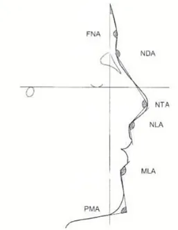 Figure 8 (13) : Angles faciaux. FNA= angle frontonasal ; NDA= proéminence nasale ; NTA=  angle de la pointe du  nez ; NLA= angle nasolabial ; MLA= angle labiomentonnier et PMA= angle mentonnier 