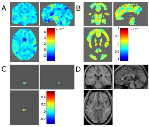 Fig. 1. Weights of the SVM model discriminating between CTRL (label +1) and IPD (label -1) based on the combination of the BRISK and COMF conditions, for A the whole brain, B, motor and C MLR masks (Note that the cross-hair position has been centred on the