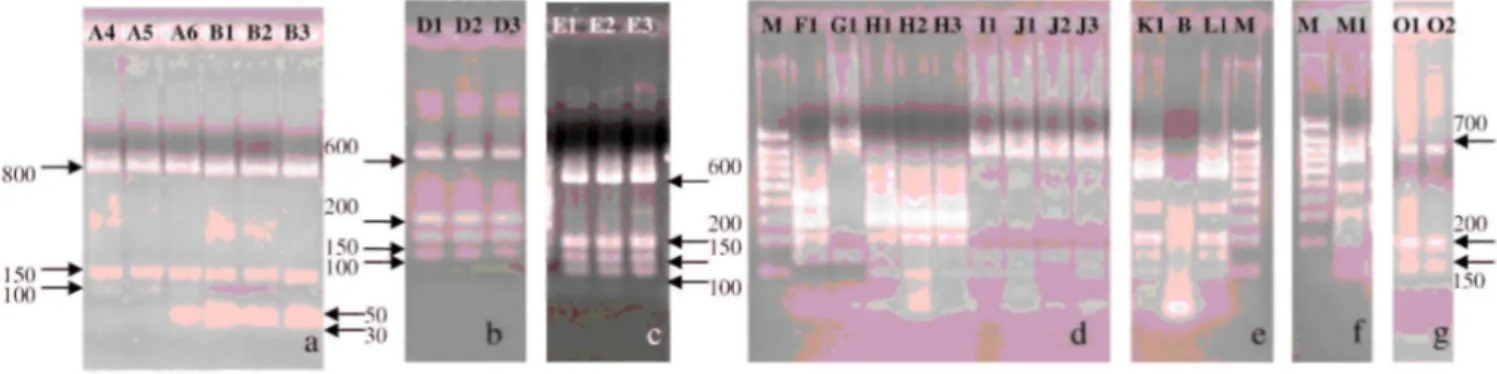 FIGURE 1. Alu/ restriction digest patterns. B, blanc; M, 5 µl molecular-weight marker (1,000-800-700-600- (1,000-800-700-600-500-400-300-200-100 bp)