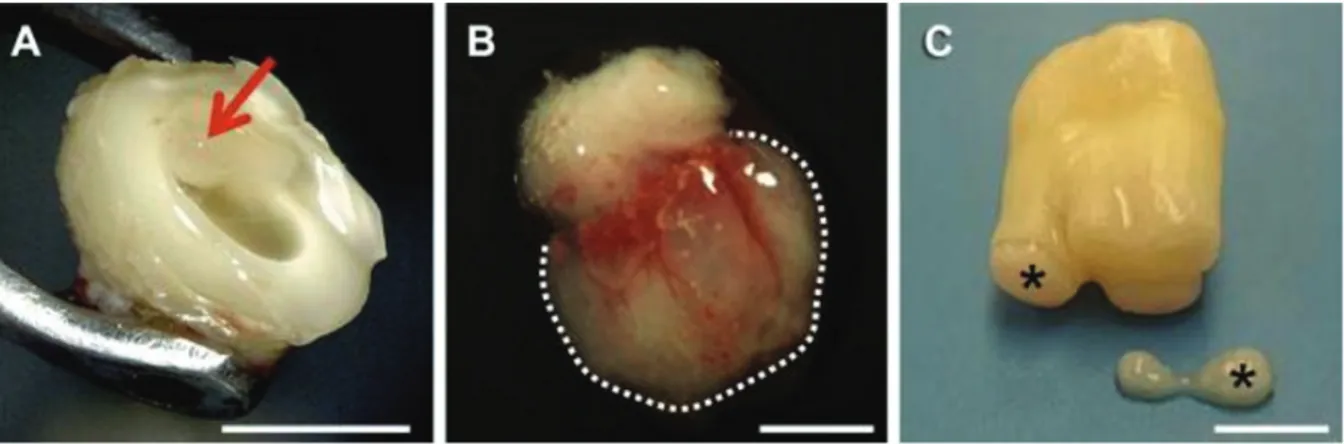 Figure 5 : Exemple de sources de cellules souches adultes dans le tissu  dentaire. (A): Le tissu pulpaire exposé contient des DPSCs