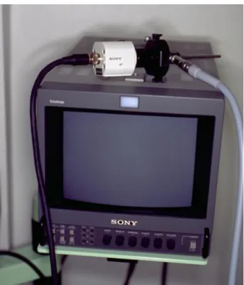 Figure 2 : Otoendoscope avec écran 