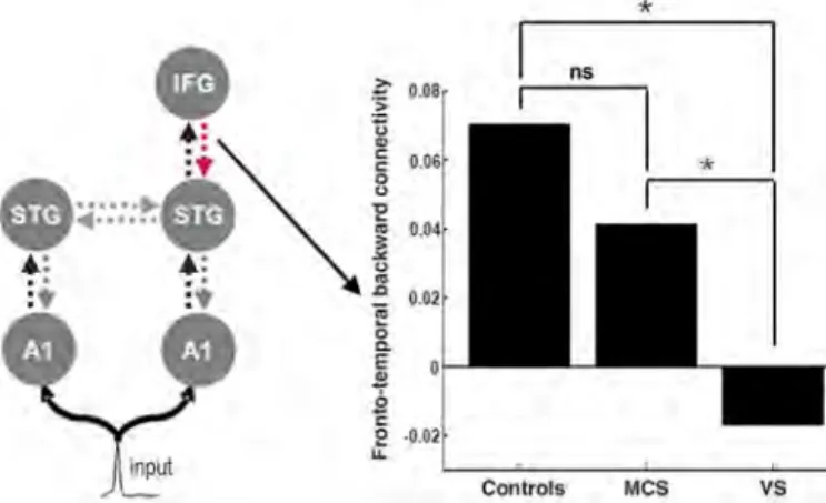 Fig. 4. Quantitative ef- ef-fective connectivity  anal-ysis revealed that the only significant difference  be-tween VS patients and controls was an  impair-ment of backward  con-nectivity from frontal to temporal cortex