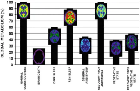 Fig. 2.3 Global cerebral metabolism in various states (adapted from Laureys et al. 2004a)