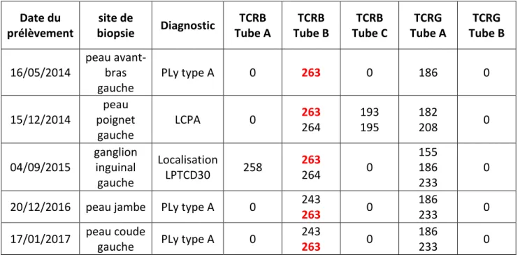 Tableau 1 : Résumé des analyses de clonalité des prélèvements de LPTCD30. 