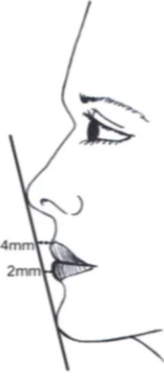 Figure 14. Ligne de Ricketts située à 4 mm ± 2 mm du bord libre de la lèvre supérieure et à                     2 mm ± 2 mm du bord libre de la lèvre inférieure.  