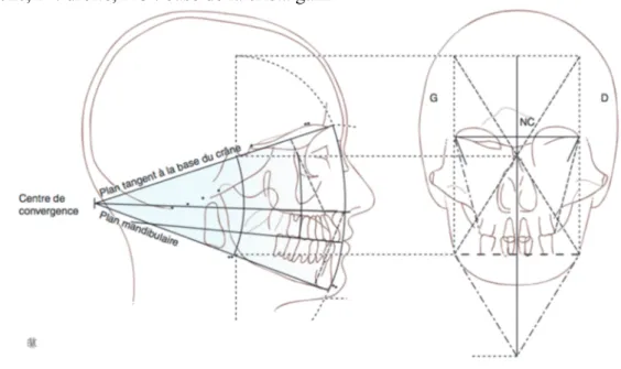 Figure 15. Exemple d’analyse dans les 3 dimensions des céphalogrammes de face et de profil  selon Sassouni
