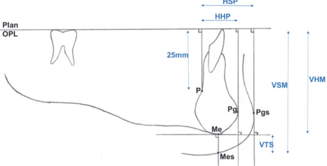 Figure  1.  Schéma  des  différents  points  repères  placés  dans  un  repère  orthonormé  sur  les  téléradiographies  de  profil  ayant  servi  à  évaluer  le  déplacement dans l’espace du menton osseux et des tissus mous